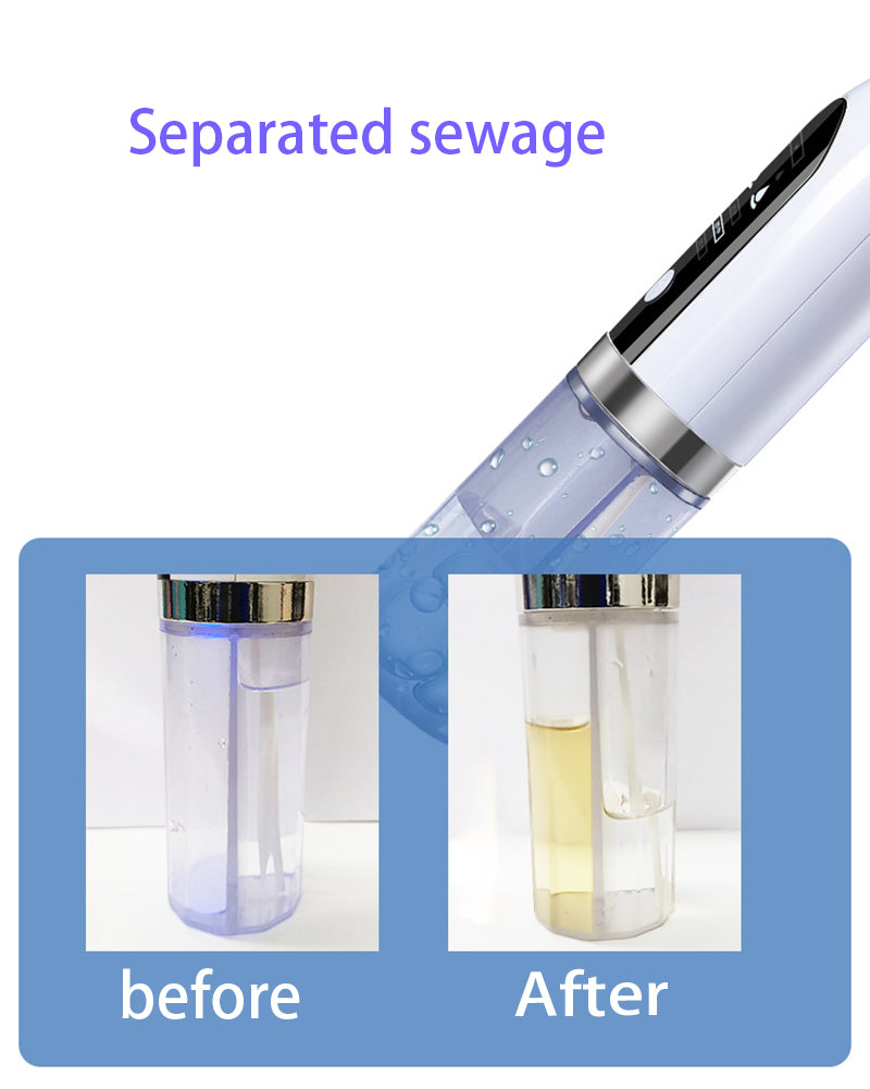 Blackhead Remover Pore Vacuum Cleaner – Deep Facial Cleansing & Smooth Skin